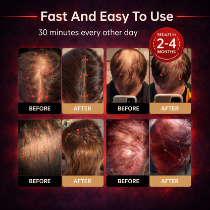 REVYVE™ - Red Light Therapy Regrowth Cap